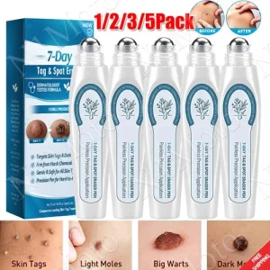 5x Tag &Spot Eraser Mole Skin Tags Removal Tool Eraser Pen Painless Long-Lasting